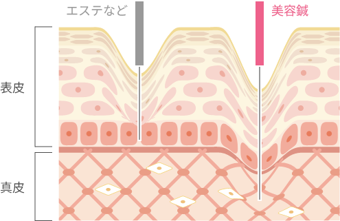 美容鍼灸で起こる変化